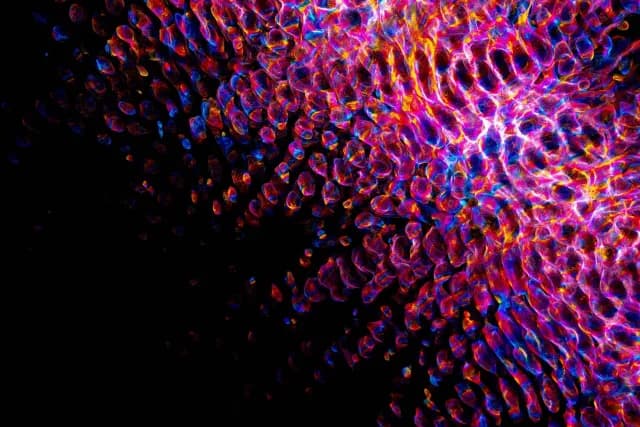 What is Digital Transformation